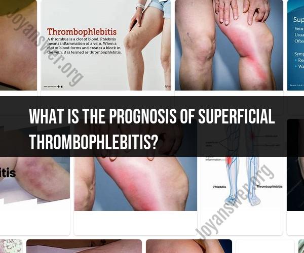 Prognosis of Superficial Thrombophlebitis: What to Expect and How to Manage