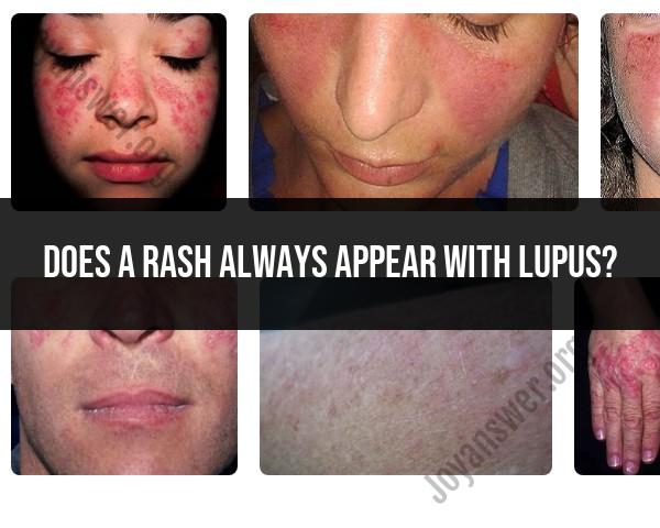 Rash Appearance in Lupus: Lupus Symptom Consistency