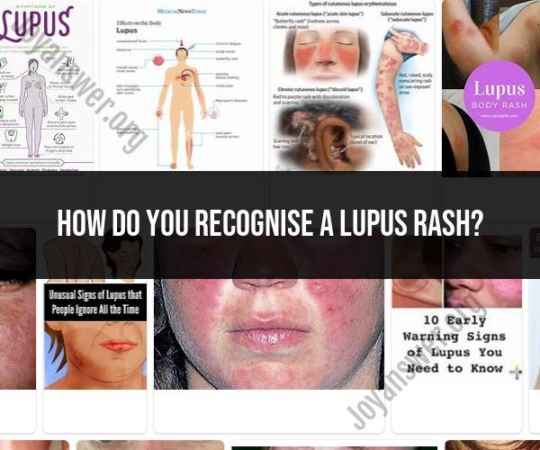 Recognizing a Lupus Rash: Identifying Symptoms and Seeking Prompt Diagnosis