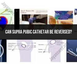 Reversing a Suprapubic Catheter: Medical Considerations