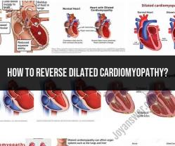 Reversing Dilated Cardiomyopathy: Treatment and Lifestyle Changes