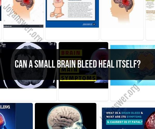 Self-Healing of Small Brain Bleeds: Can Brain Bleeds Heal on Their Own?