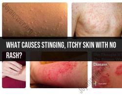 Stinging and Itchy Skin with No Rash: Causes and Remedies