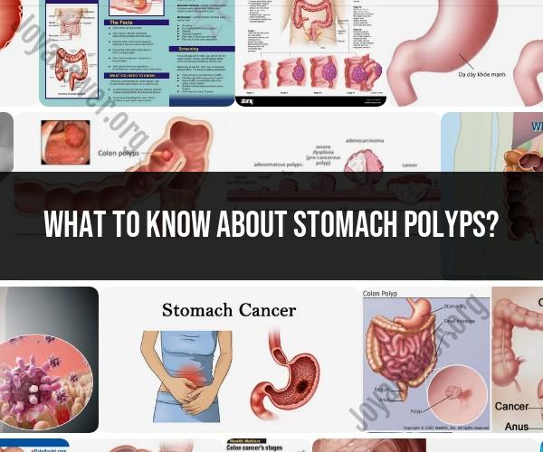 Stomach Polyps: What You Need to Know