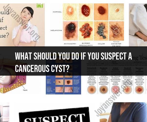 Suspecting a Cancerous Cyst: What to Do Next