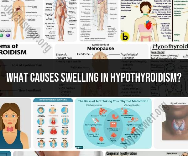 Swelling in Hypothyroidism: Thyroid Disorder Symptom