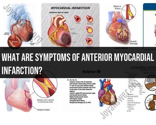 Symptoms of Anterior Myocardial Infarction: What to Watch For