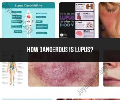 The Danger of Lupus: Health Implications