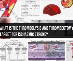 Thrombolysis and Thrombectomy Targets for Ischaemic Stroke