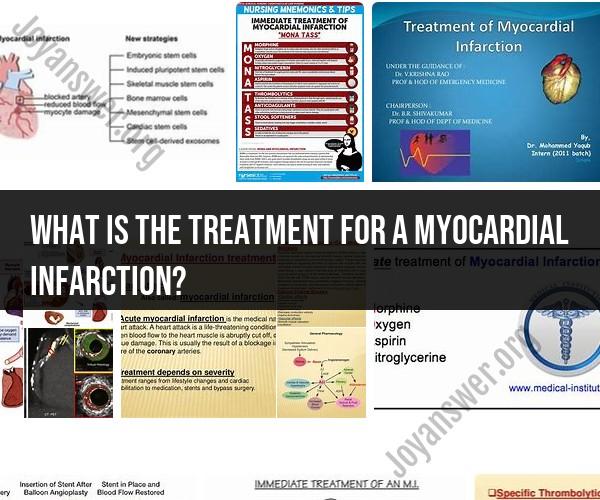 Treatment for Myocardial Infarction: Medical Procedures and Care