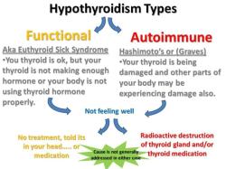 Uncovering the Challenges of Hypothyroidism: Health Implications