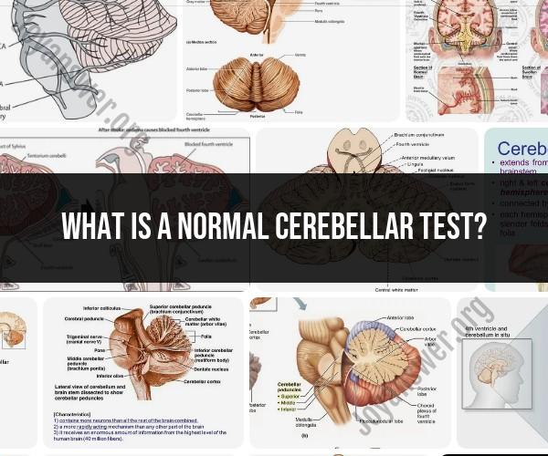Understanding a Normal Cerebellar Test: Insights and Significance