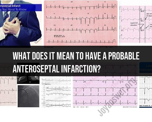 Understanding a Probable Anteroseptal Infarction
