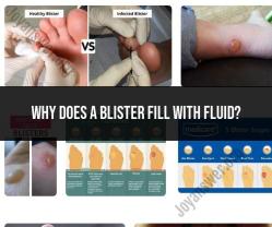 Understanding Blister Formation: Causes and Mechanisms