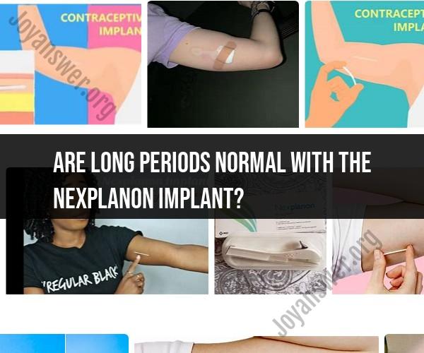 Understanding Long Menstrual Periods with the Nexplanon Implant