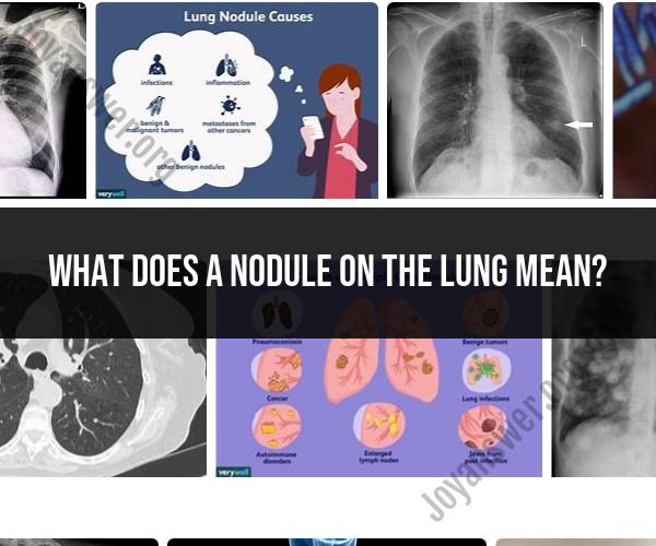 Understanding Lung Nodules: Causes and Implications