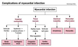 Understanding Myocardial Infarction and Its Causes