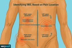 Understanding Right Quadrant Pain: What Does It Feel Like?