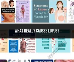 Understanding the Causes of Lupus: Medical Insights