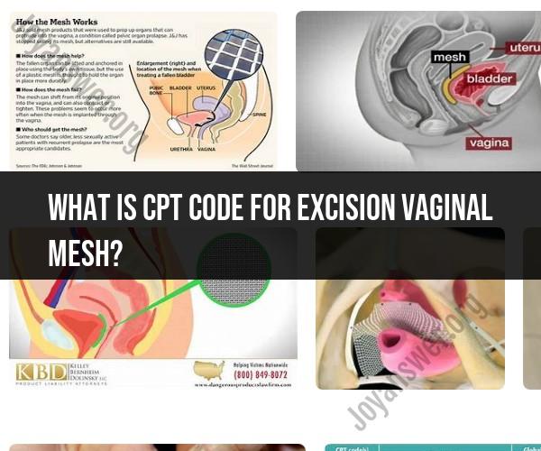 Understanding the CPT Code for Vaginal Mesh Excision