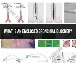 Understanding the Enclosed Bronchial Blocker: An Essential Medical Device