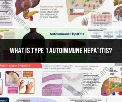 Understanding Type 1 Autoimmune Hepatitis: Causes and Treatment