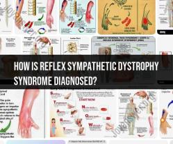 Unraveling the Diagnosis of Reflex Sympathetic Dystrophy Syndrome