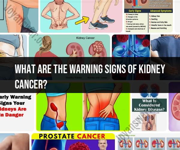 Warning Signs of Kidney Cancer: Recognizing Symptoms