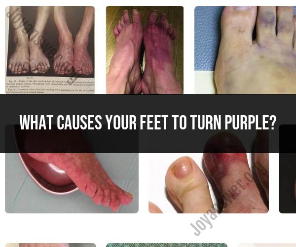 What Causes Purple Feet: Insights into Skin Discoloration