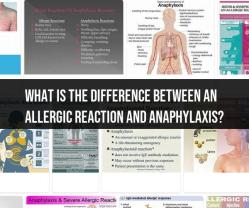 Allergic Reaction vs. Anaphylaxis: Understanding the Difference