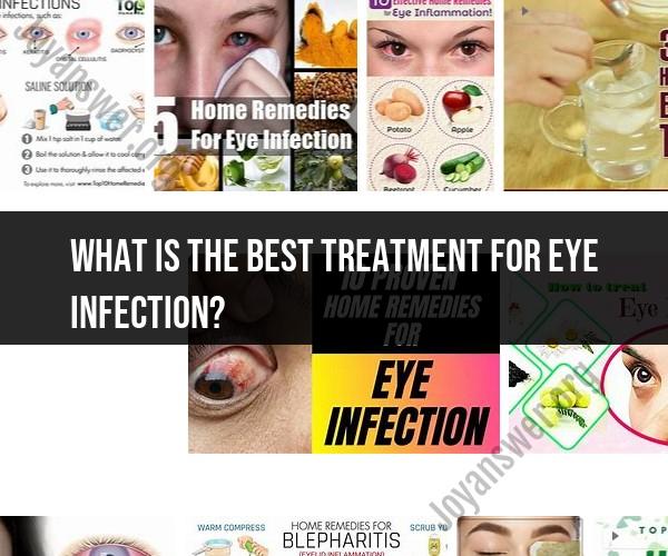 Best Treatment for Eye Infections: Safeguarding Ocular Health