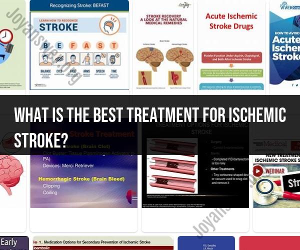 Best Treatment for Ischemic Stroke: Approaches to Restore Blood Flow and Prevent Recurrence