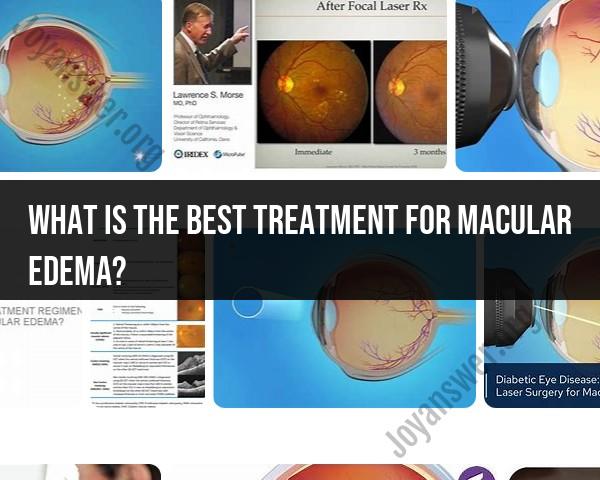 Best Treatment for Macular Edema: Effective Solutions