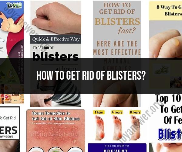 Bid Farewell to Blisters: How to Get Rid of Them