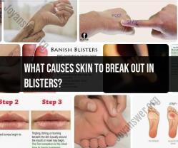 Blisters and Skin Breakouts: Causes and Prevention