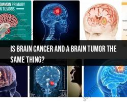 Brain Cancer vs. Brain Tumors: Clarifying the Terminology