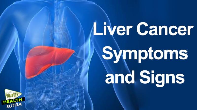 Cancer Awareness: What Is the Sign for Liver Cancer?