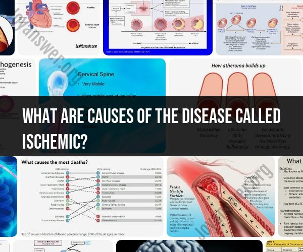 Causes of Ischemic Disease: Understanding the Factors
