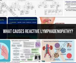 Causes of Reactive Lymphadenopathy: What You Should Know