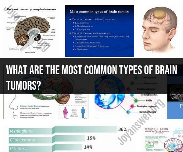 Common Types of Brain Tumors: An Overview