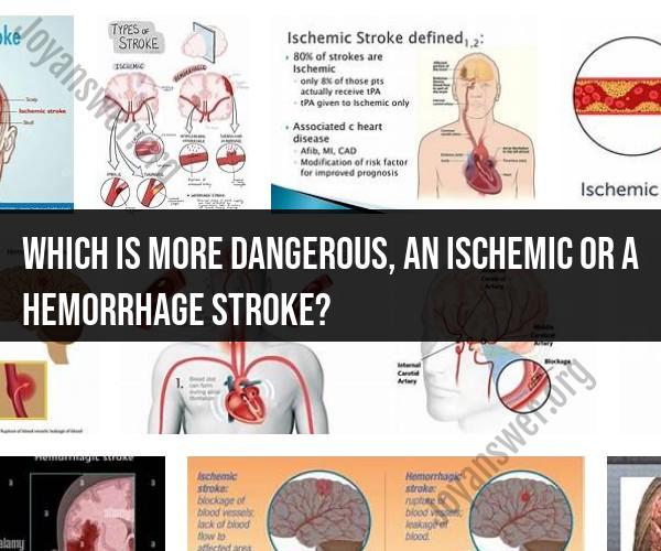Comparing the Dangers: Ischemic vs. Hemorrhagic Stroke