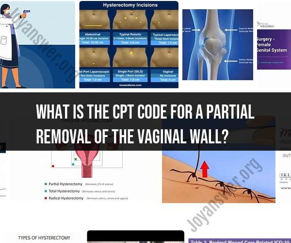 CPT Code for Partial Vaginal Wall Removal: Clarification