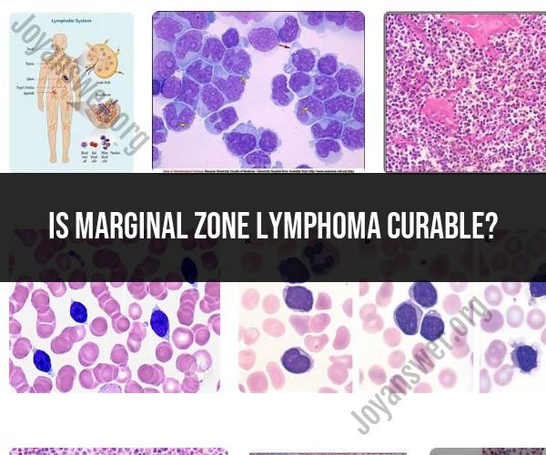 Curability of Marginal Zone Lymphoma: Medical Insights